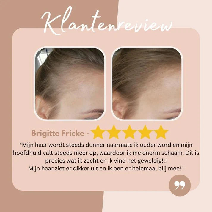 50% Korting | EasyBlend™  Dekt haaruitgroei onmiddelijk [Laatste dag Korting]