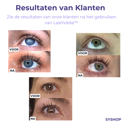LashVeda™ Wimperserum – Langere & Dichtere Wimpers | 1+1 Gratis