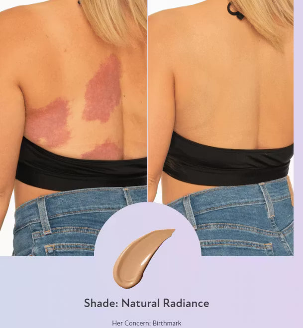 Concealer – Perfecte huid voor het hele lichaam [50% korting]
