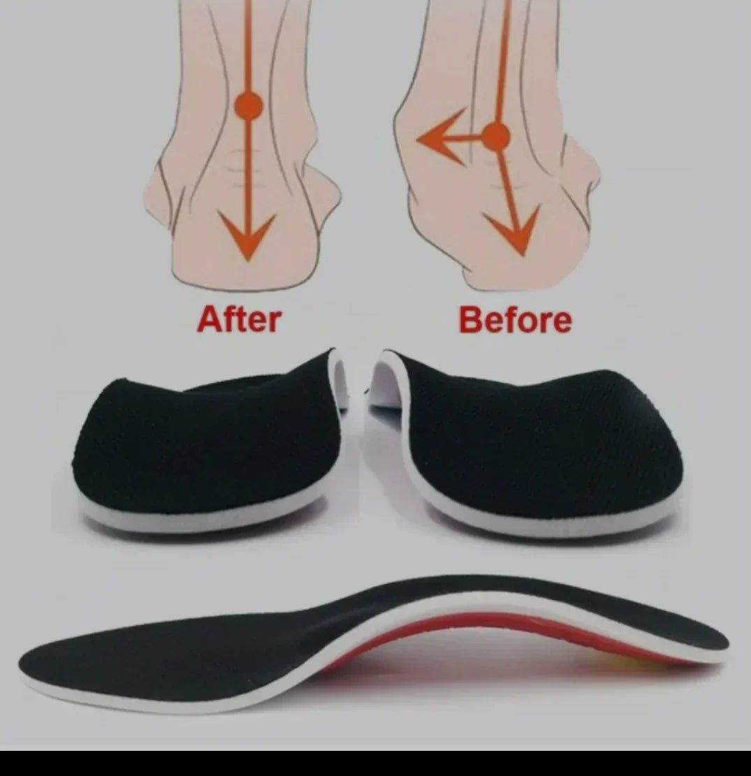 ArchEase™ - Orthopedische binnenzool [1 + 1 Gratis]