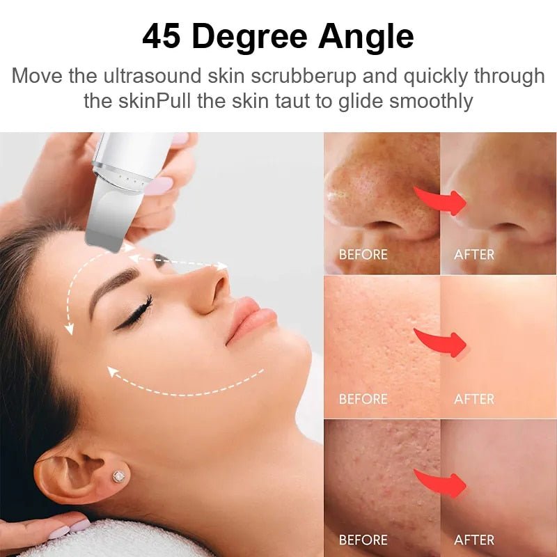 SkinElixir™ - Ontdek onberispelijke schoonheid [50% Korting]